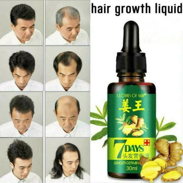GINGER GERMINAL OIL for fast hair growth in 7 Days