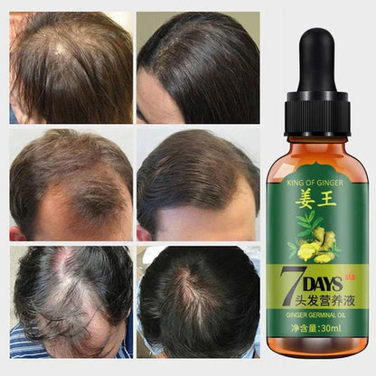 GINGER GERMINAL OIL for fast hair growth in 7 Days